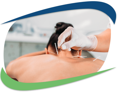 dry-needling-we